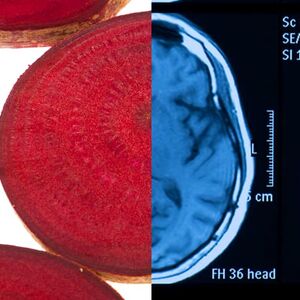 Beets-and-Brain-Health
