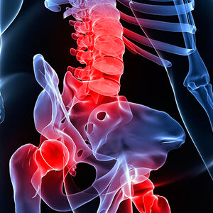 Bulge-Bad-for-Bones-4