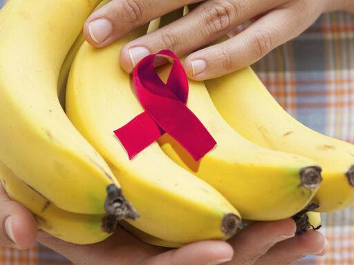 Bananas-and-HIV