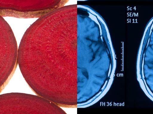Beets-and-Brain-Health